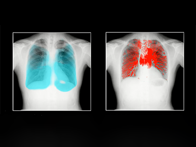 Research56「肺機能を，動画で見える化！」