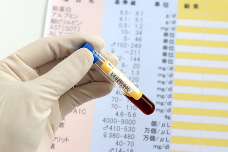 池江璃花子選手が公表した白血病。その症状や治療法は？